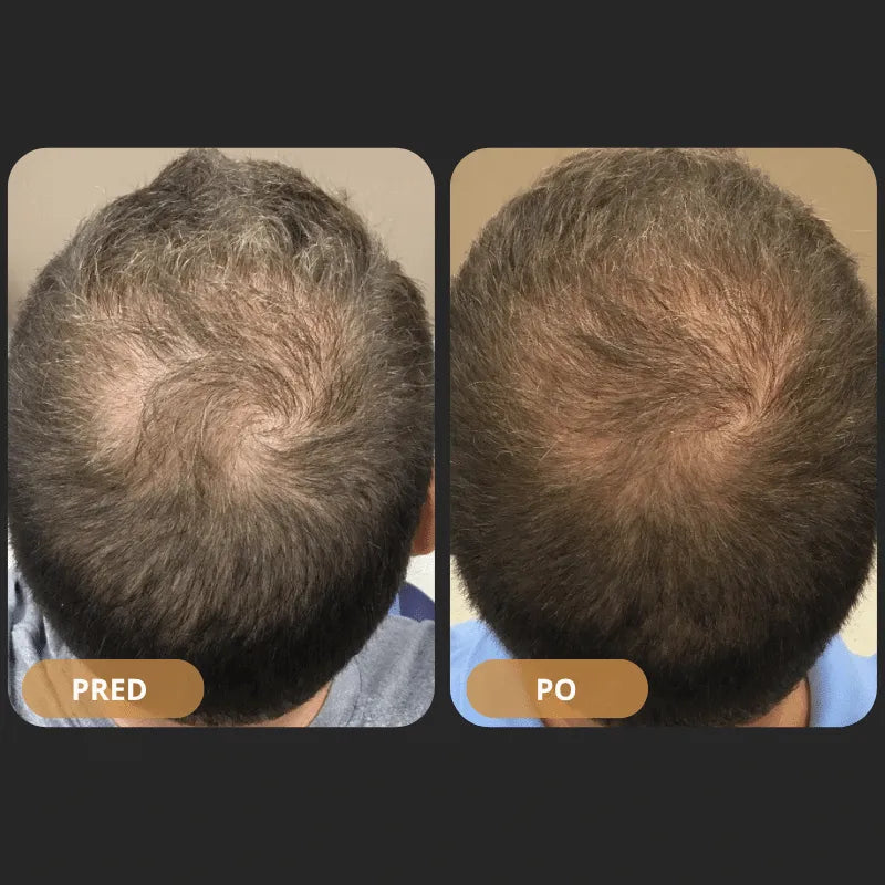 Orylo™ RootBoost šampon za regeneracijo las