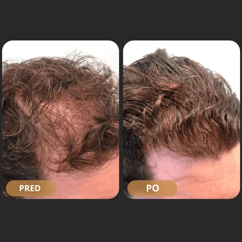 Orylo™ RootBoost šampon za regeneracijo las