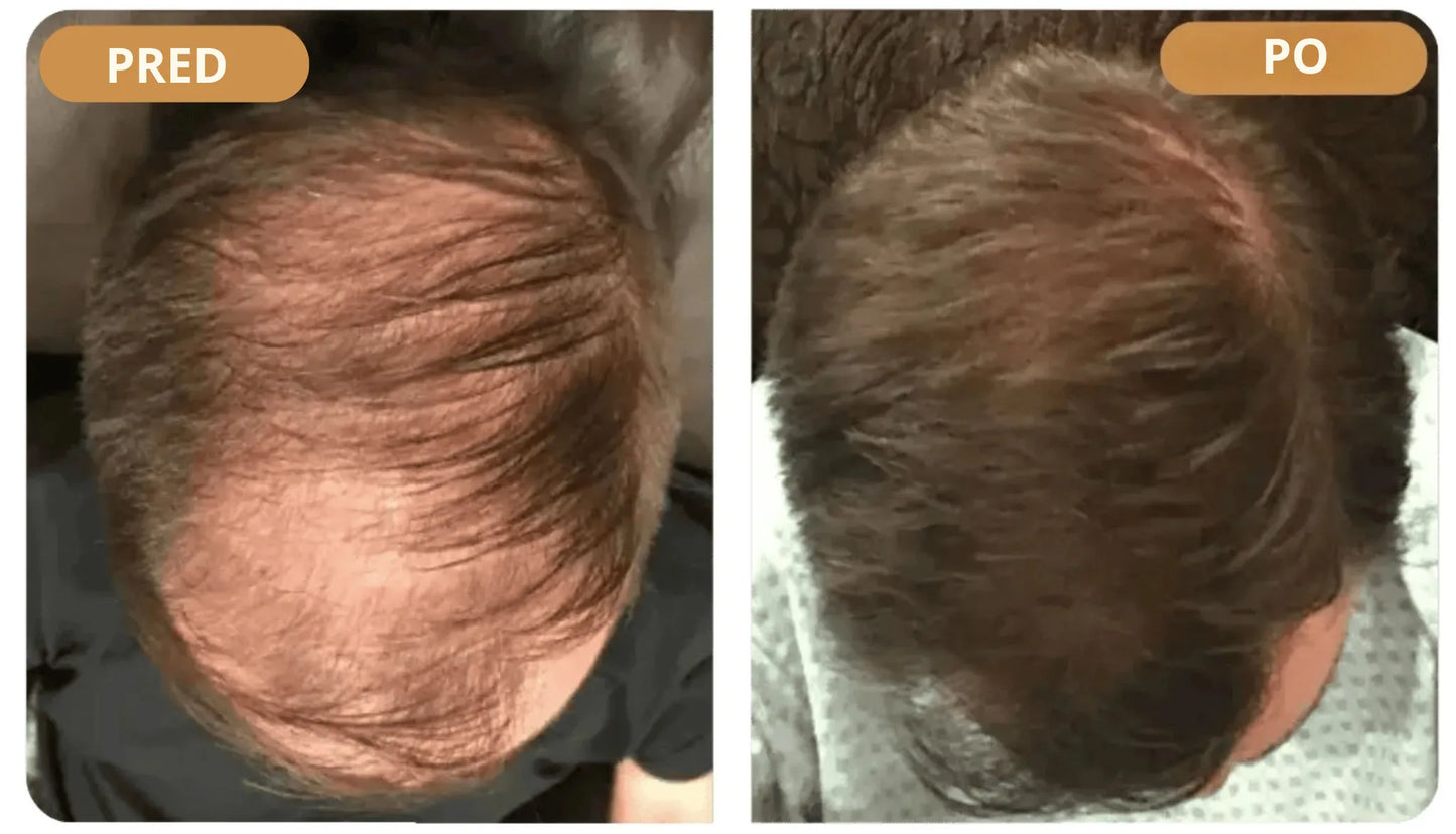 Orylo™ RootBoost šampon za regeneracijo las