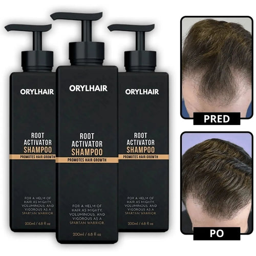 Orylo™ RootBoost šampon za regeneracijo las