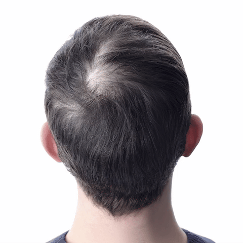 Orylo™ RootBoost šampon za regeneracijo las