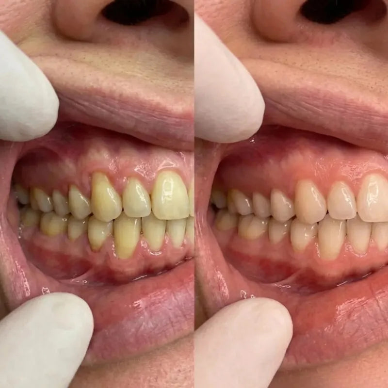 Collagen Powder for Gums