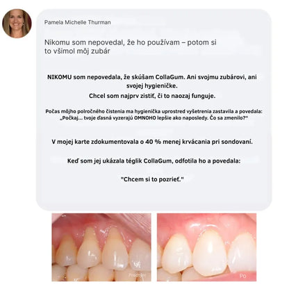 Collagen Powder for Gums