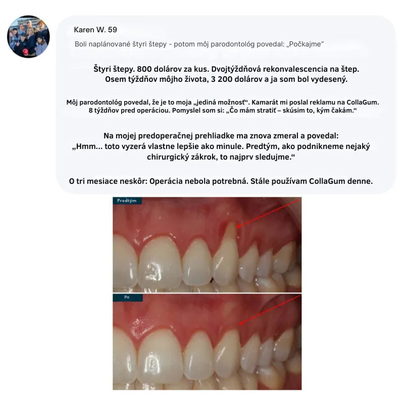 Collagen Powder for Gums