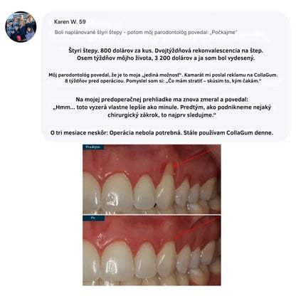 Collagen Powder for Gums