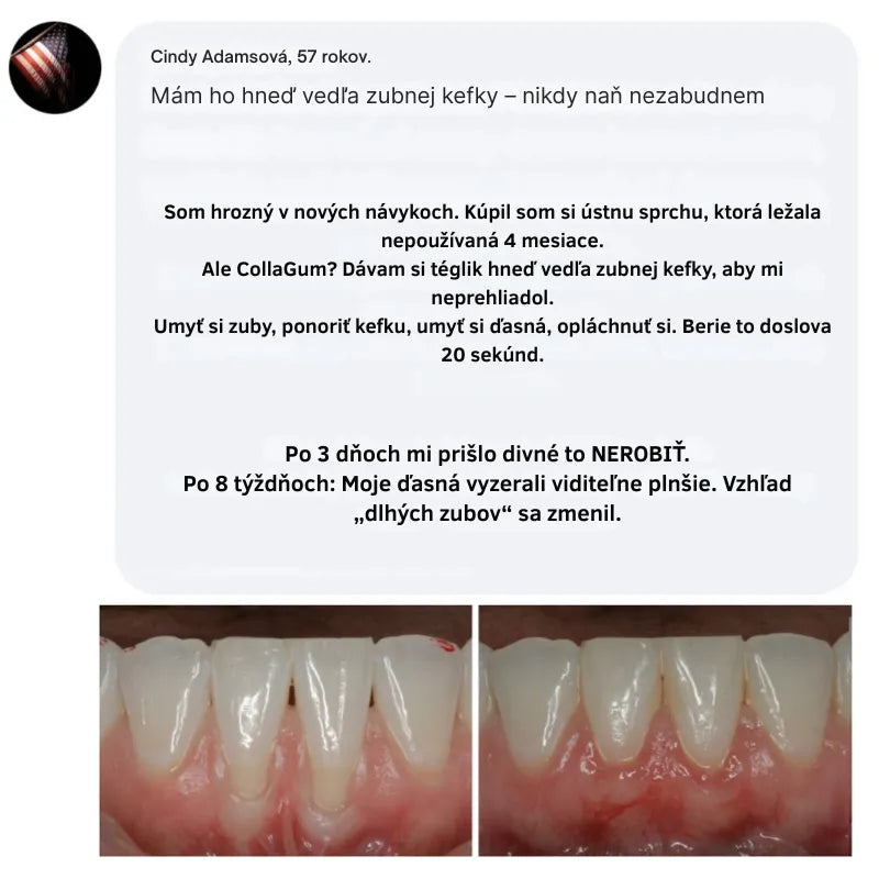 Collagen Powder for Gums