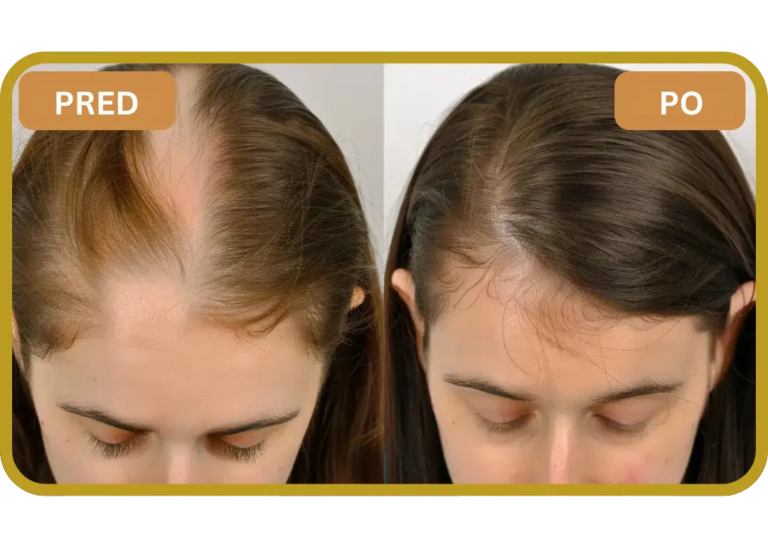 Orylo™ RootBoost Šampón na regeneráciu vlasov v2 (Women)