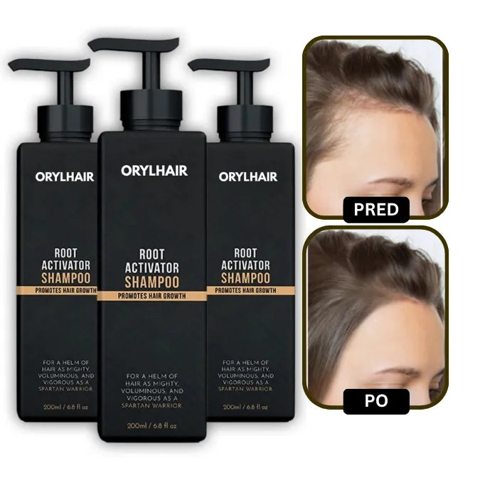 Orylo™ RootBoost Šampón na regeneráciu vlasov v2 (Women)