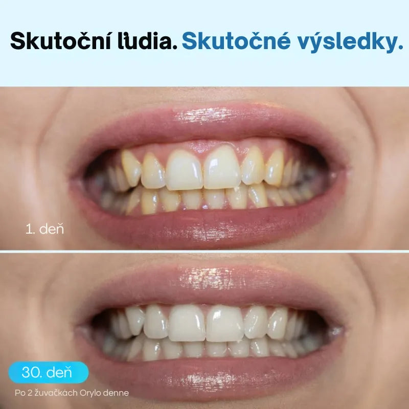 Žuvačka na bielenie zubov