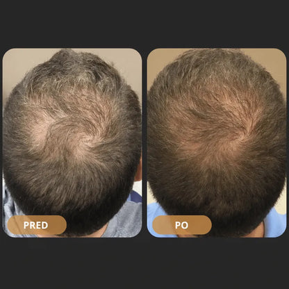 Orylo™ RootBoost šampon za regeneracijo las