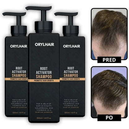 Orylo™ RootBoost šampon za regeneracijo las