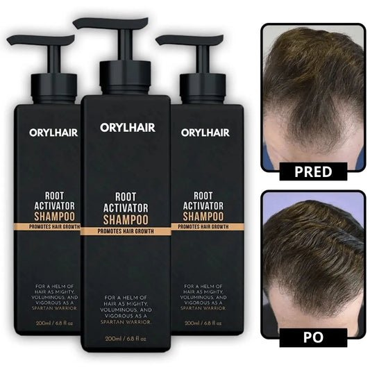 Orylo™ RootBoost šampon za regeneracijo las